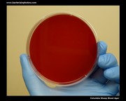 Columbia sheep blood agar